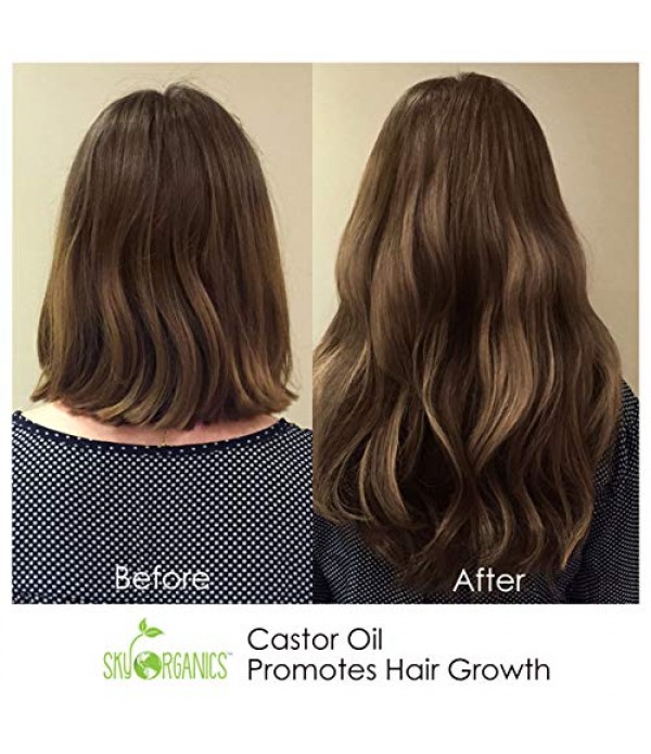 Castor Oil USDA Organic Cold-Pressed (16oz) 100% Pure Hexane-Free Castor Oil - Conditioning & Healing, For Dry Skin, Hair Growth - For Skin, Hair Care, Eyelashes - Caster Oil By Sky Organics