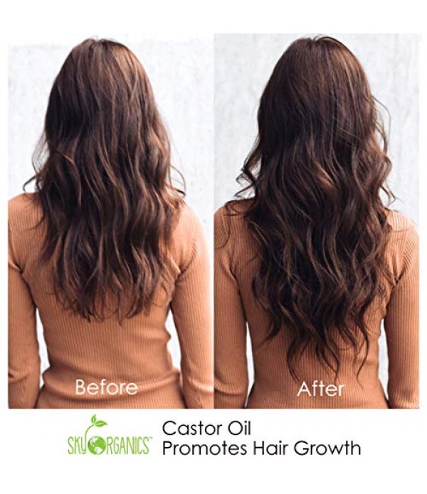 Castor Oil USDA Organic Cold-Pressed (16oz) 100% Pure Hexane-Free Castor Oil - Conditioning & Healing, For Dry Skin, Hair Growth - For Skin, Hair Care, Eyelashes - Caster Oil By Sky Organics